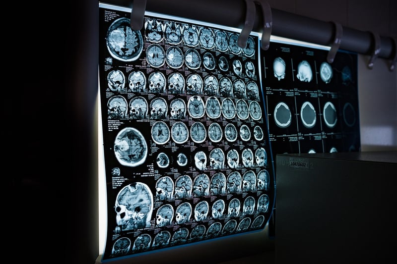 Sensory Awareness Scan
